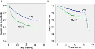 Effect of Microvascular Invasion on the Prognosis in Hepatocellular Carcinoma and Analysis of Related Risk Factors: A Two-Center Study